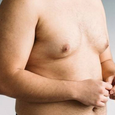 男性女乳症手術示意
